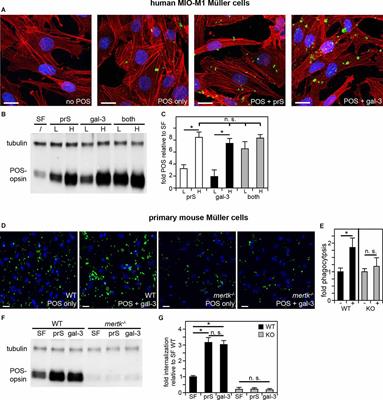 Galectin-3 Promotes Müller Glia Clearance Phagocytosis via MERTK and Reduces Harmful Müller Glia Activation in Inherited and Induced Retinal Degeneration